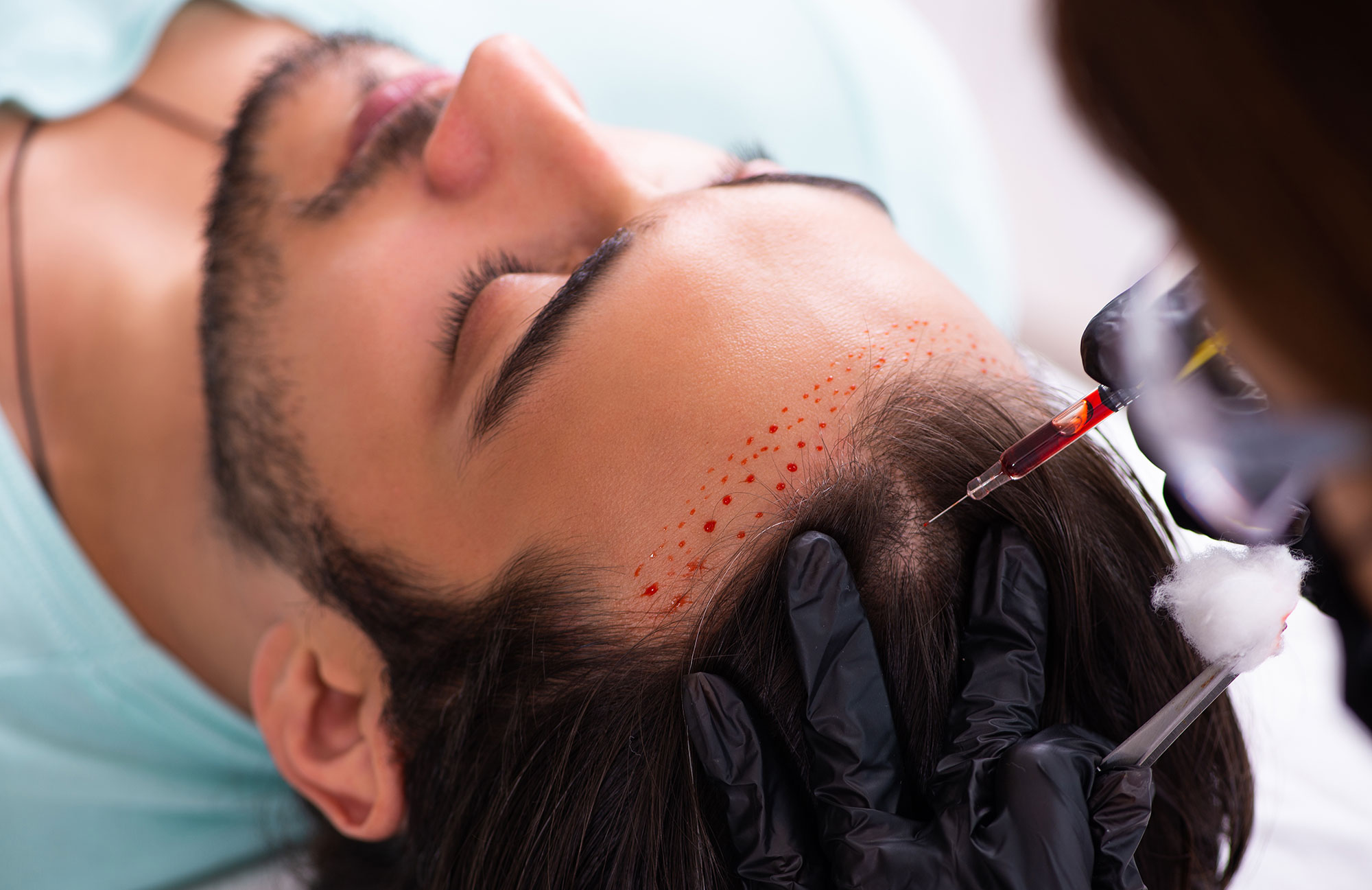 Young man visiting female beautician in hair transplantation